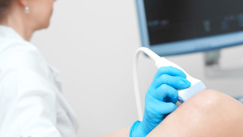 Cropped close up of a female doctor using ultrasound scanner examining injured knee of her patient pain arthritis injury healthcare medicine profession occupation technology.